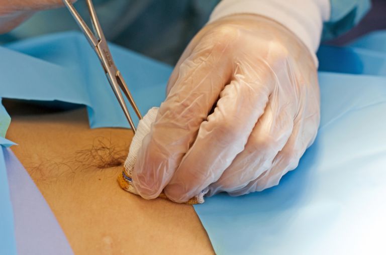 アメリカの医療格差とワクチン政策公衆衛生の未来を支えるために