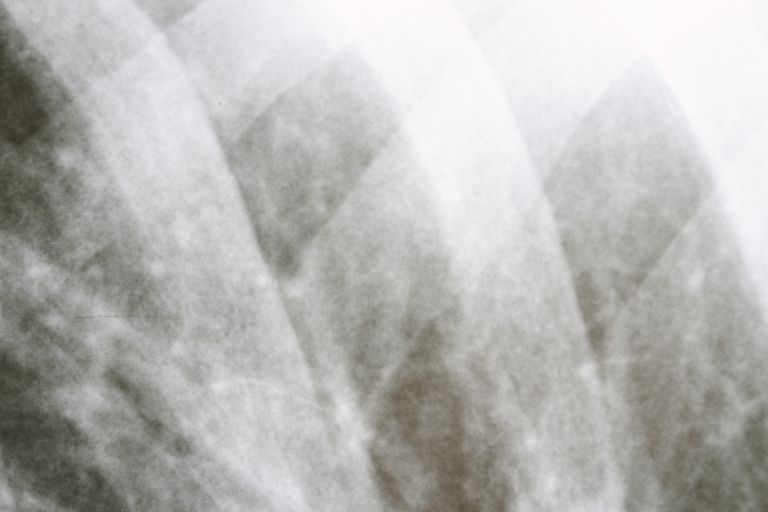 アメリカの多様性が映す医療とワクチン政策の進化と課題に迫る